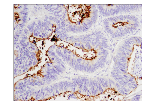 Immunohistochemistry Image 2: CD133 (D2V8Q) Rabbit Monoclonal Antibody (BSA and Azide Free)