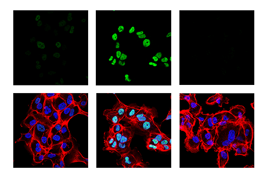Immunofluorescence Image 1: Phospho-c-Jun (Ser63) (E6I7P) Rabbit Monoclonal Antibody