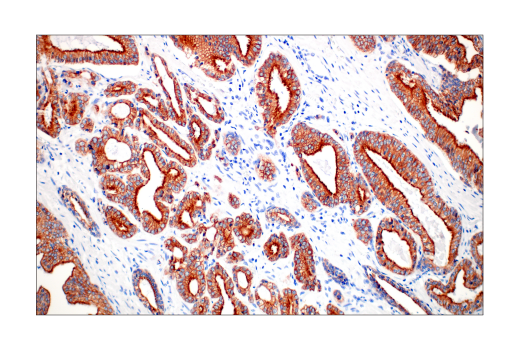 Immunohistochemistry Image 8: Pan-Keratin (C11) Mouse Monoclonal Antibody