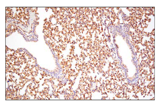 Immunohistochemistry Image 8: APP (E3F3P) Rabbit Monoclonal Antibody (BSA and Azide Free)