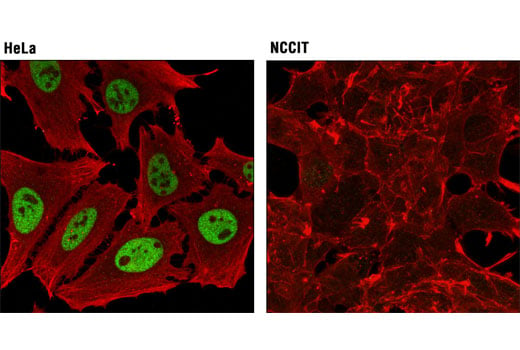 Immunofluorescence Image 1: BRM (D9E8B) XP<sup>®</sup> Rabbit mAb