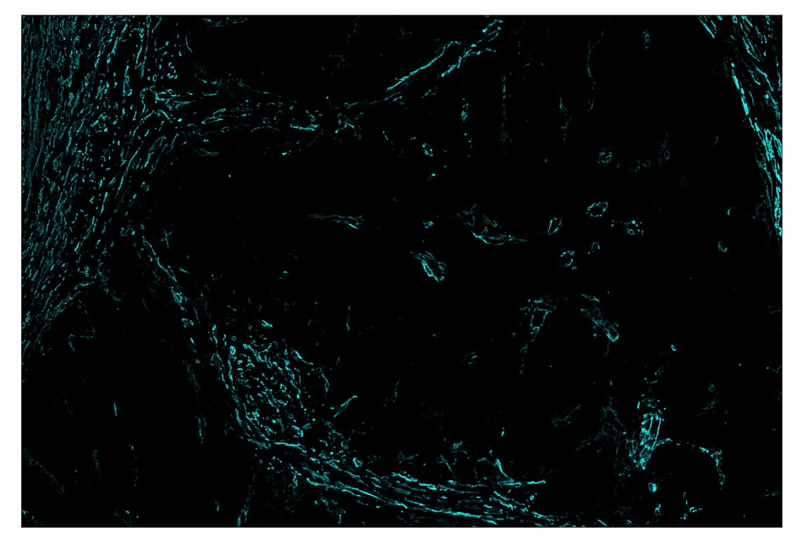 Immunohistochemistry Image 6: α-Smooth Muscle Actin (D4K9N) & CO-0024-594 SignalStar<sup>™</sup> Oligo-Antibody Pair