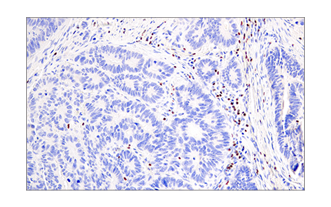 Immunohistochemistry Image 1: Helios (E4L5U) Rabbit Monoclonal Antibody