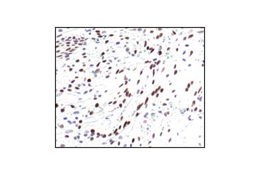 Immunohistochemistry Image 5: Phospho-c-Jun (Ser63) (54B3) Rabbit Monoclonal Antibody (BSA and Azide Free)