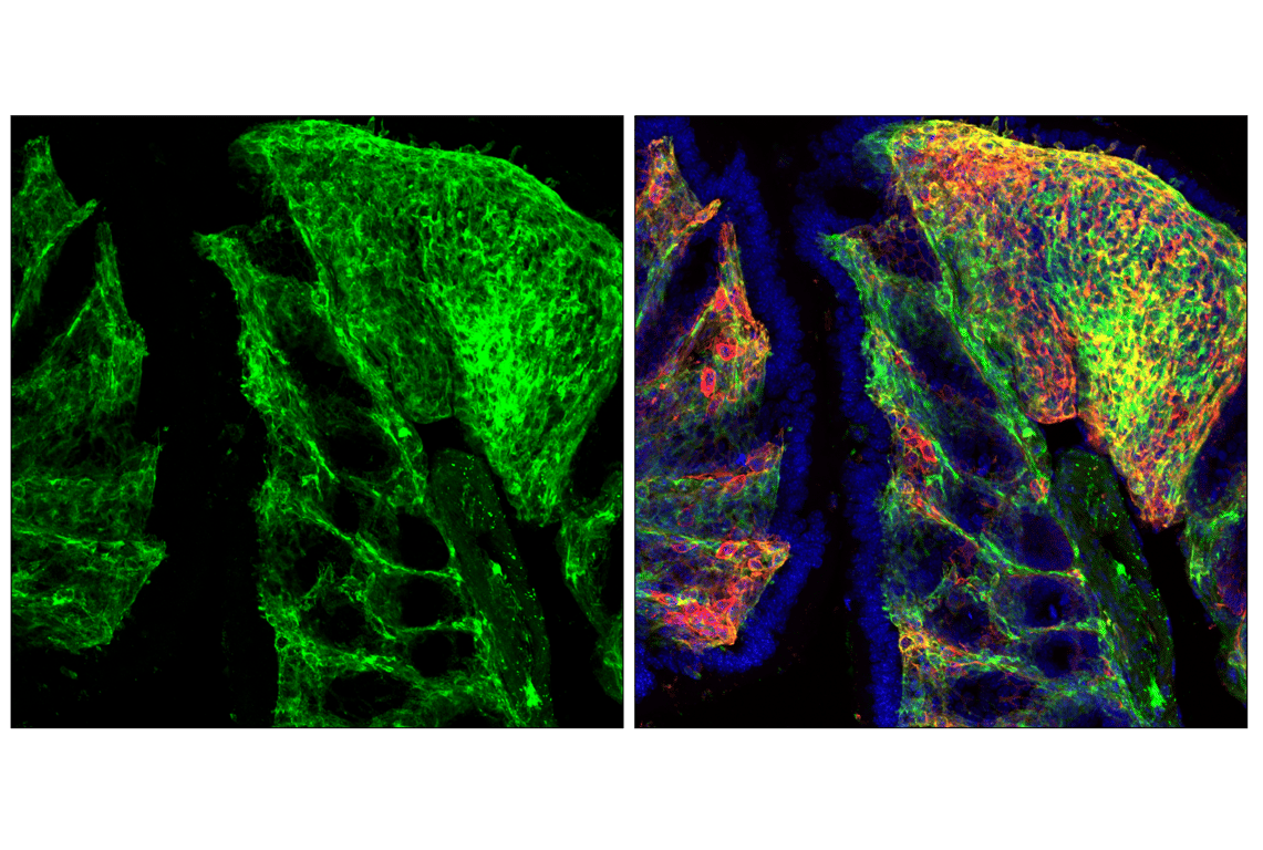 Immunofluorescence Image 3: Axl (F3K7B) Rabbit Monoclonal Antibody