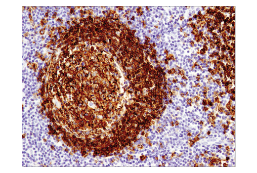 Immunohistochemistry Image 5: CD19 (Intracellular Domain) (D4V4B) Rabbit Monoclonal Antibody (BSA and Azide Free)
