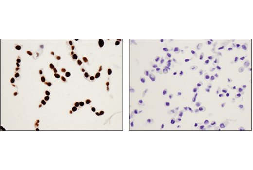 Immunohistochemistry Image 2: WT1 (D8I7F) Rabbit Monoclonal Antibody (BSA and Azide Free)