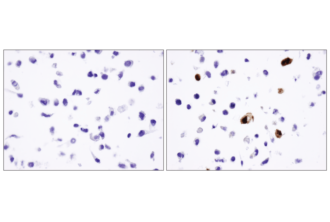 Immunohistochemistry Image 1: DYKDDDDK Tag (D6W5B) Rabbit Monoclonal Antibody (Binds to same epitope as Sigma-Aldrich Anti-FLAG M2 antibody)