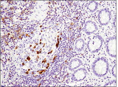 Immunohistochemical analysis of paraffin-embedded human tonsil using CD19 (Intracellular Domain) (D4V4B) XP<sup>®</sup> Rabbit mAb.