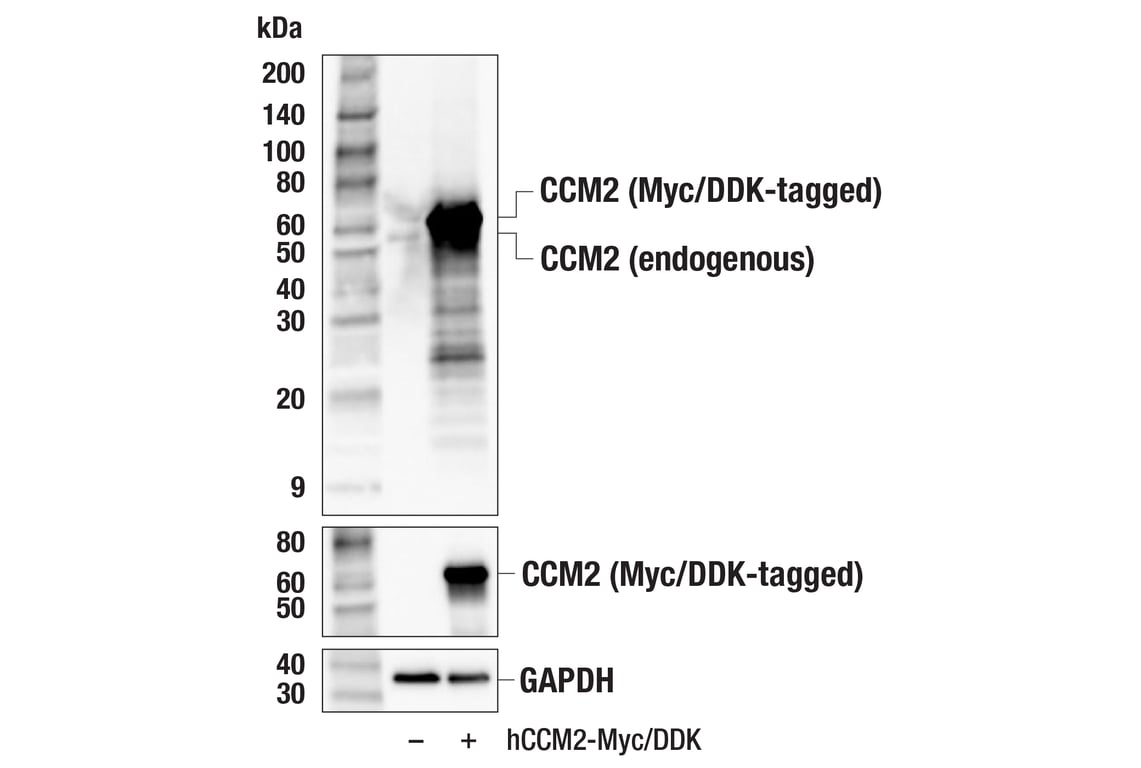 Western Blotting Image 2: CCM2 (F8G7Z) Rabbit Monoclonal Antibody