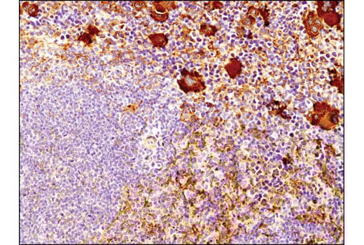 Immunohistochemistry Image 3: Vinculin (E1E9V) Rabbit Monoclonal Antibody