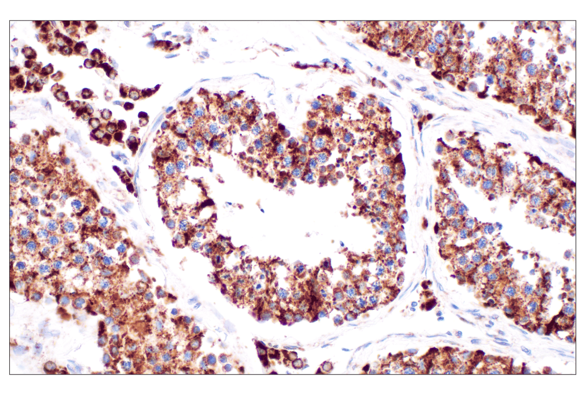 undefined Image 34: Organelle Localization IF Antibody Sampler Kit