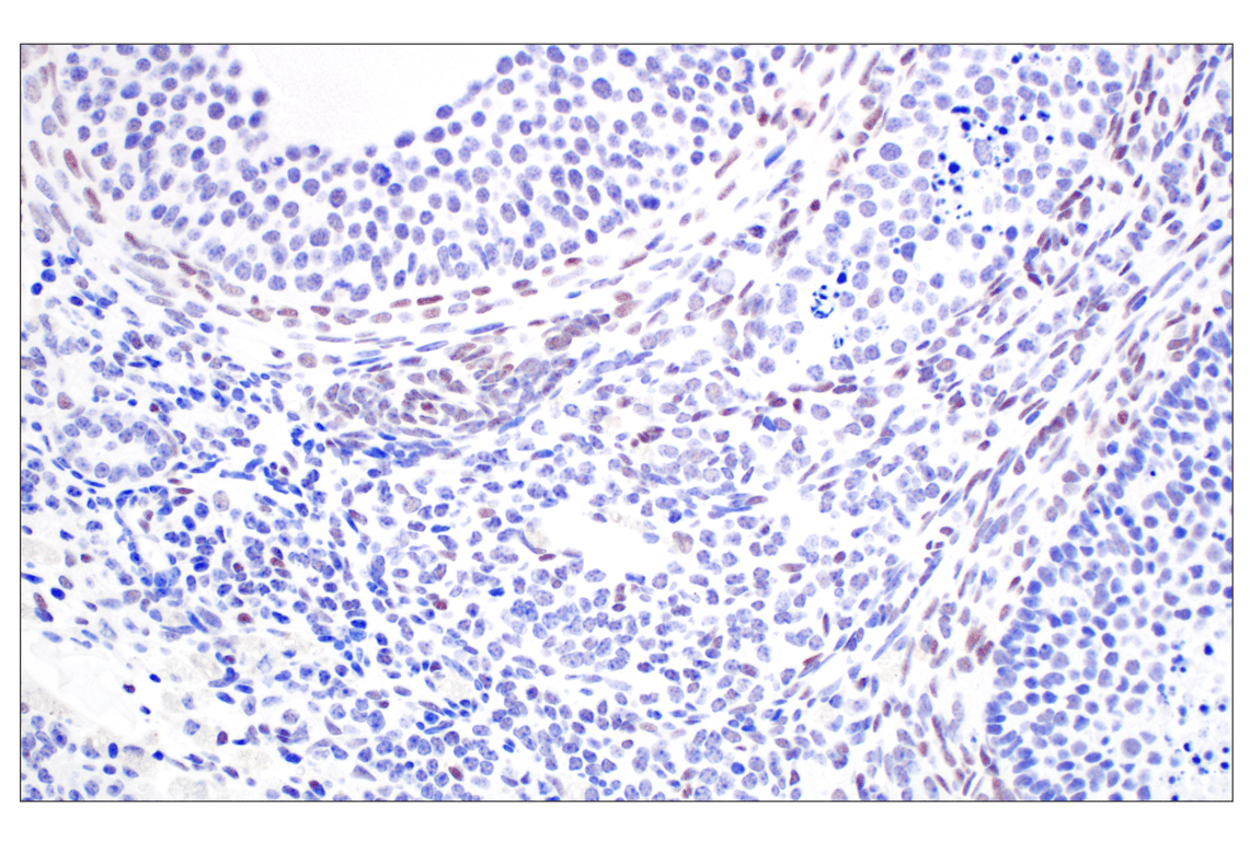 Immunohistochemistry Image 7: TCF4/ITF2 (E3X2Y) Rabbit Monoclonal Antibody