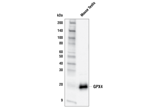 undefined Image 16: Ferroptosis Antibody Sampler Kit