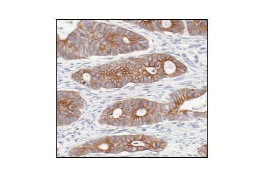 Immunohistochemistry Image 3: Pan-Keratin (C11) Mouse Monoclonal Antibody