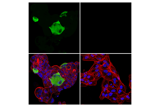 Immunofluorescence Image 1: Tyrosine Hydroxylase (LNC1) Mouse Monoclonal Antibody