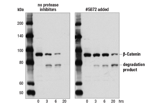 Protease Phosphatase Inhibitor Cocktail (100X) #5872 | Cell