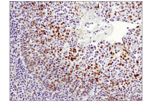 Immunohistochemistry Image 5: LRF/Pokemon (D7U2O) Rabbit Monoclonal Antibody
