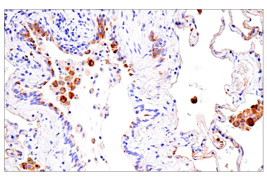 Immunohistochemistry Image 5: CEACAM6 (E7S7Y) Rabbit Monoclonal Antibody (BSA and Azide Free)