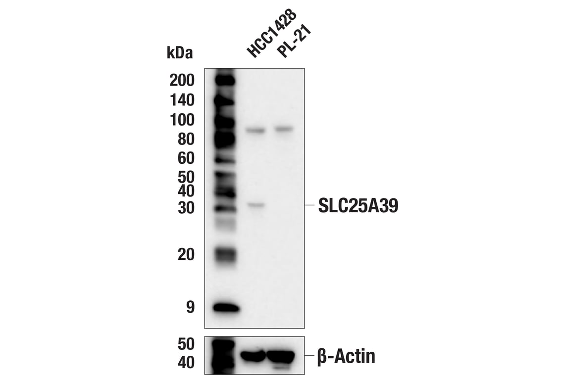 Western Blotting Image 2: SLC25A39 (F2F6O) Rabbit Monoclonal Antibody