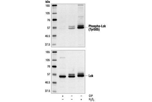 Western Blotting Image 1: Lck Antibody