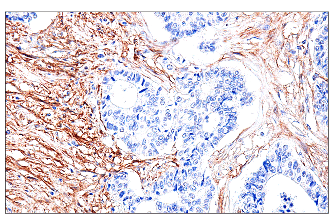 Immunohistochemistry Image 6: FAP (F1A4G) Rabbit Monoclonal Antibody (BSA and Azide Free)