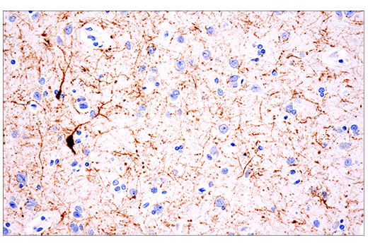 Immunohistochemistry Image 1: Calretinin (E7R6O) Rabbit Monoclonal Antibody (BSA and Azide Free)