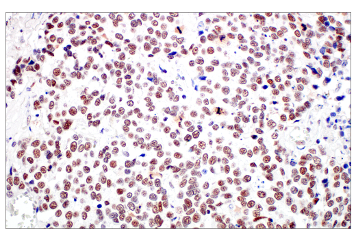 Immunohistochemistry Image 4: XRCC1 (E4A3V) Rabbit Monoclonal Antibody