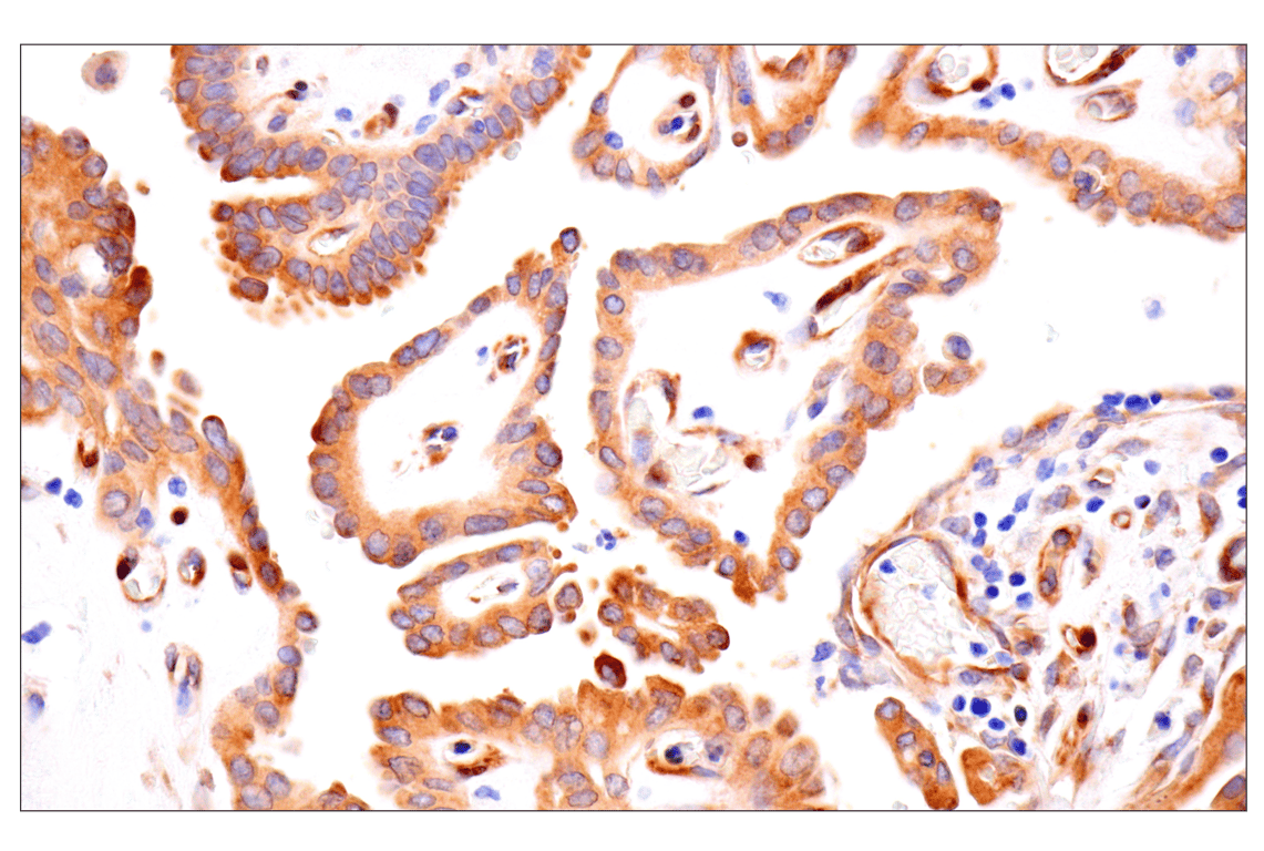 Immunohistochemistry Image 3: FAK (F7Z4C) Mouse Monoclonal Antibody (BSA and Azide Free)