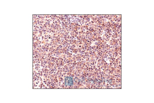 Immunohistochemistry Image 4: S6 Ribosomal Protein (5G10) Rabbit Monoclonal Antibody