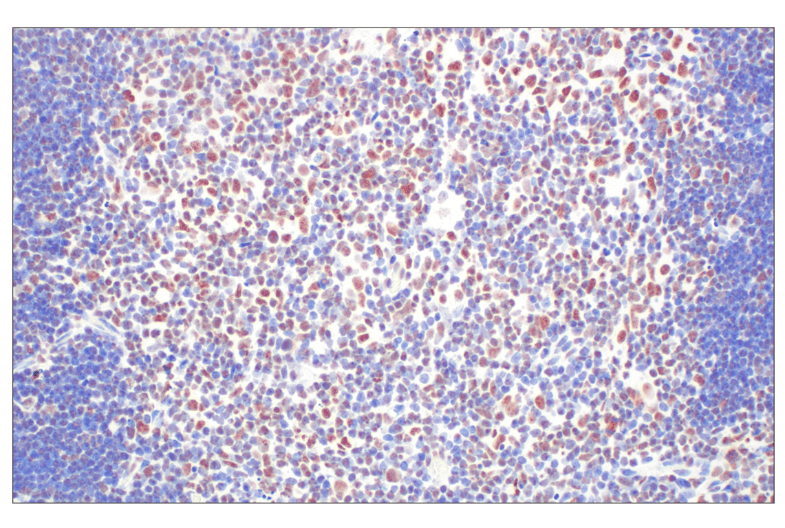 Immunohistochemistry Image 12: CBX7 (E7N1W) Rabbit Monoclonal Antibody