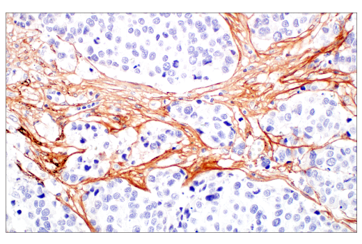Immunohistochemistry Image 6: COL3A1 (E8D7R) Rabbit Monoclonal Antibody