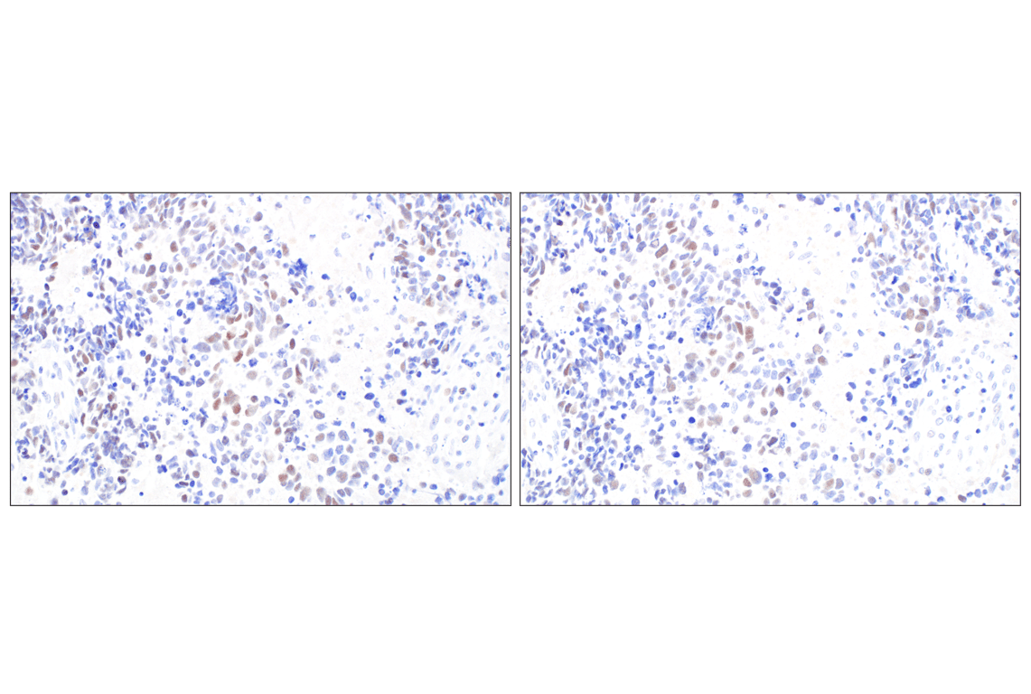 Immunohistochemistry Image 6: MASTL (F7I2C) Rabbit Monoclonal Antibody