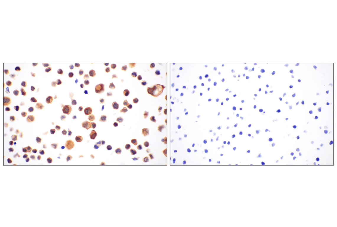 Immunohistochemistry Image 11: PIP4K2C (E7P3S) Rabbit Monoclonal Antibody