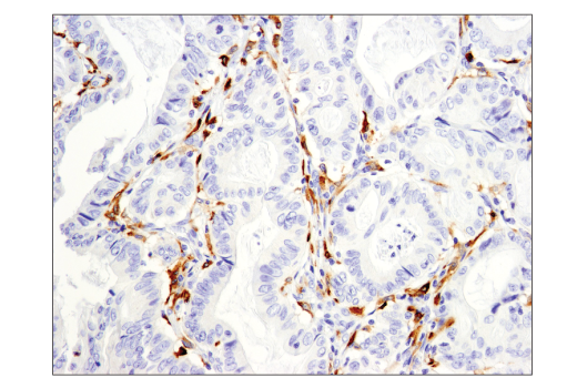 Immunohistochemistry Image 1: CD163 (D6U1J) Rabbit Monoclonal Antibody (BSA and Azide Free)