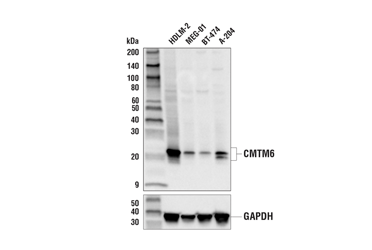 Western Blotting Image 3: CMTM6 (E6A8T) Rabbit Monoclonal Antibody