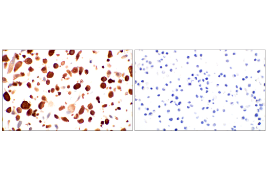 Immunohistochemistry Image 10: HSP20 (E6O7A) Rabbit Monoclonal Antibody