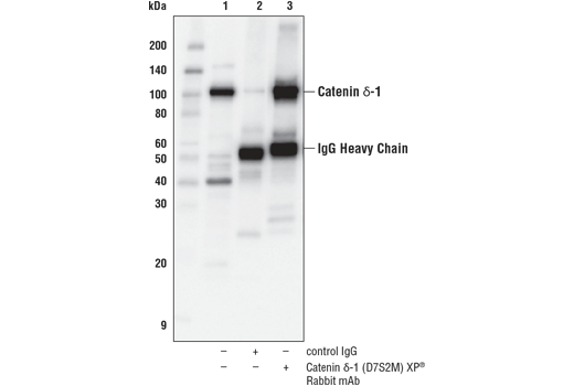 Immunoprecipitation Image 1: Catenin delta-1 (D7S2M) Rabbit Monoclonal Antibody