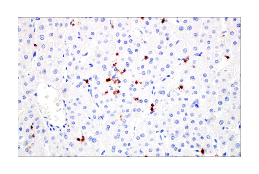 Immunohistochemistry Image 7: CD2 (D6V9F) Rabbit Monoclonal Antibody (BSA and Azide Free)