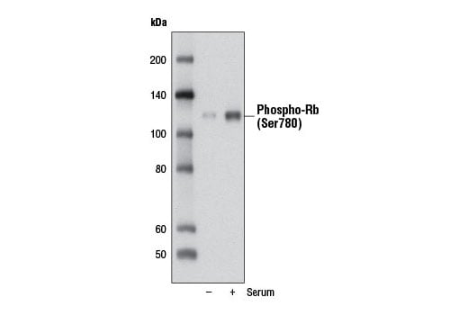 Western Blotting Image 1: Phospho-Rb (Ser780) (D59B7) Rabbit mAb