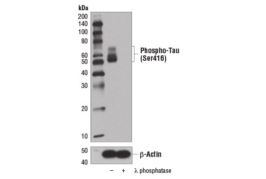 Western Blotting Image 2: Phospho-Tau (Ser416) (D7U2P) Rabbit Monoclonal Antibody