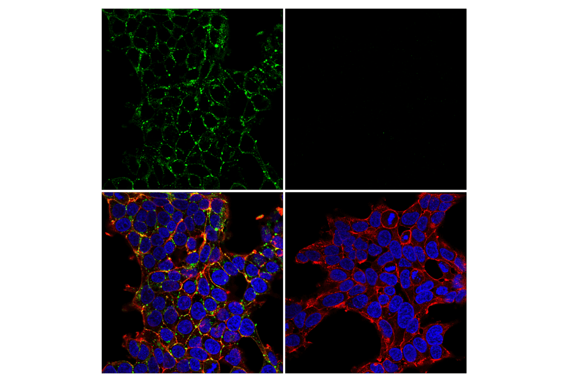 Immunofluorescence Image 2: Connexin 43 (E7N2R) Rabbit Monoclonal Antibody (BSA and Azide Free)