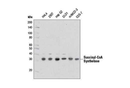 Western Blotting Image 1: Succinyl-CoA Synthetase (D8A11) Rabbit mAb