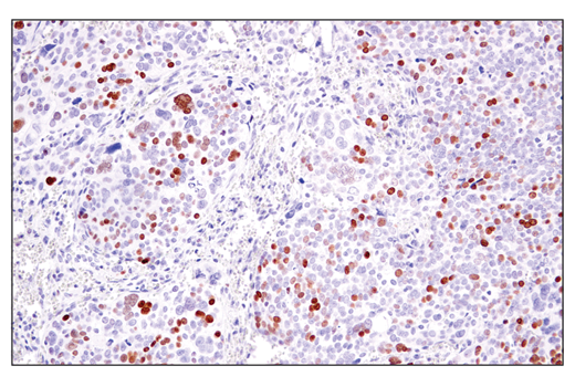 Immunohistochemistry Image 4: ATAD2 (E8Y2K) Rabbit Monoclonal Antibody