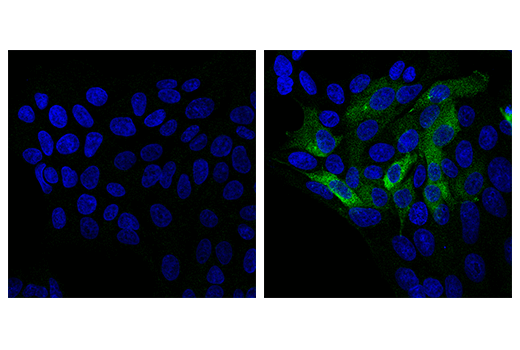 Immunofluorescence Image 1: iNOS (E3W6B) Rabbit Monoclonal Antibody