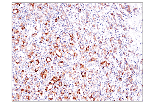 Immunohistochemistry Image 1: BCAT2 (D8K3O) Rabbit Monoclonal Antibody