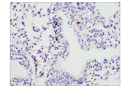 Immunohistochemistry Image 4: PD-1 (Intracellular Domain) (D7D5W) Rabbit Monoclonal Antibody (BSA and Azide Free)