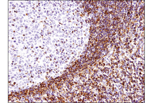 Immunohistochemistry Image 4: Bcl-2 (124) Mouse mAb (BSA and Azide Free)