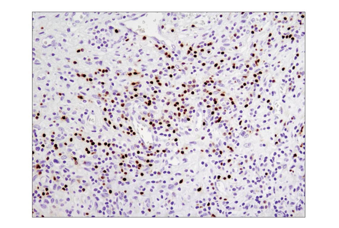 Immunohistochemistry Image 1: PAX5 (D7H5X) Rabbit Monoclonal Antibody
