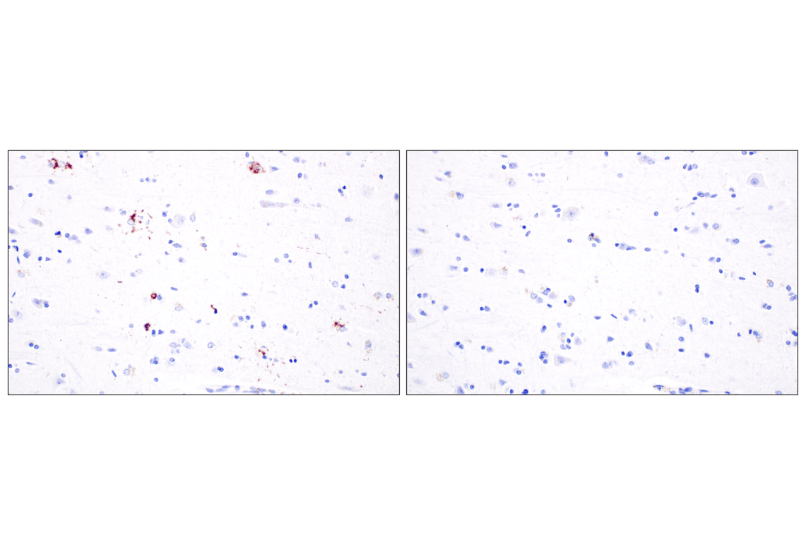 Phospho-TDP43 (Ser409/Ser410) (F9S3F) Rabbit Monoclonal Antibody